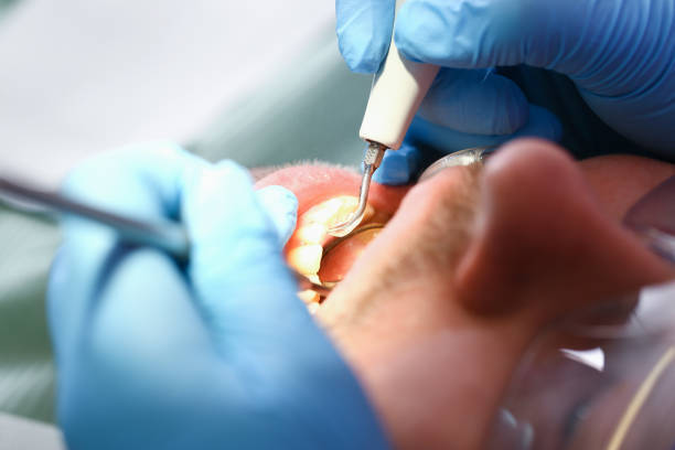 Best Teeth Whitening  in Leland, MS